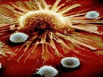 Phát hiện phương pháp “bỏ đói” tế bào ung thư 